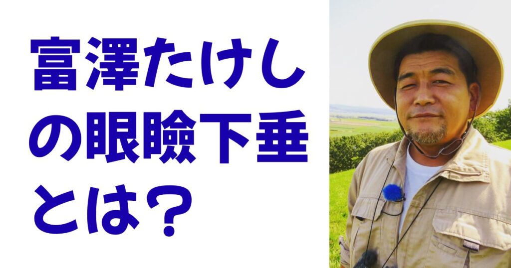 富澤たけしの眼瞼下垂とは？