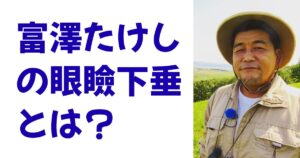 富澤たけしの眼瞼下垂とは？